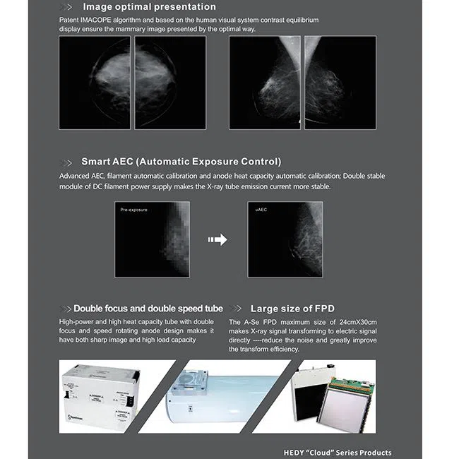 Full Digital Mammography System FM-M600 3 (1)