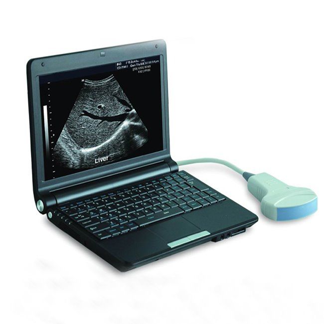 Medical Equipment Portable B/W Ultrasound Scanner with Ce ISO
