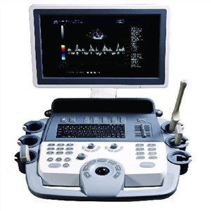Sonoscape心脏超声心动图，Sonoscape S6便携式超声回声机