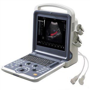 2D/3D/4D Color Doppler Diagnostic Equipment Laptop Portable Ultrasound Scanner